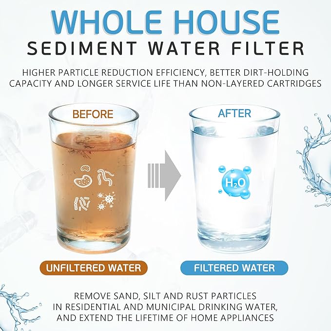 Ronaqua 20" x 4.5" Big Sediment Replacement Water Filter Cartridge, 1 Micron, NSF Certified, for Whole House, Compatible with 155358-43, 2PP20BB1M, AP810-2, FPMB-BB5-20, P5-20BB, SDC-45-2005